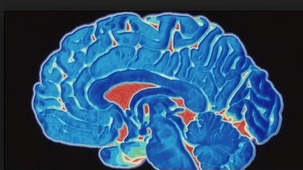 Brainwash Yourself: Understanding How Our Brain Works